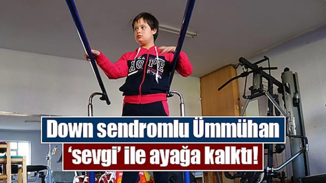 Down sendromlu Ümmühan 'sevgi' ile ayağa kalktı!