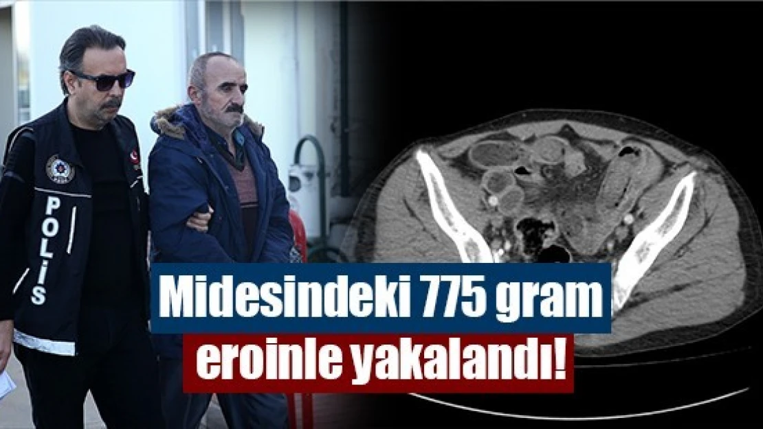 Midesindeki 775 gram eroinle yakalandı!