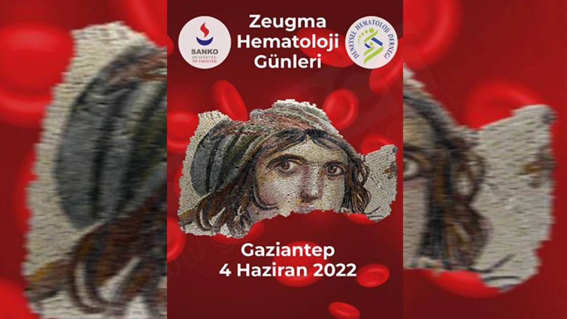 Gaziantep Zeugma hematoloji günleri başlıyor