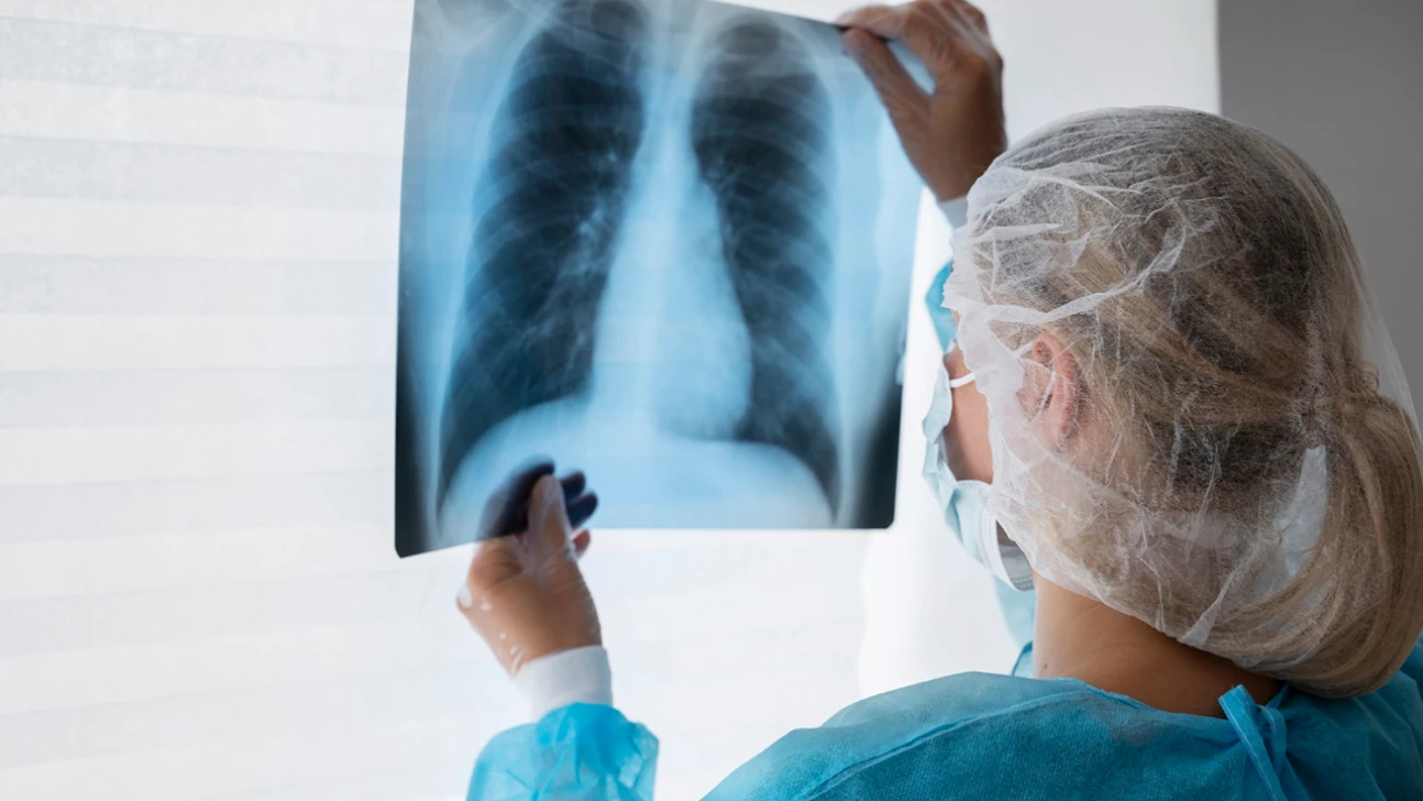 Akciğer kanserinde çevresel faktörlerin etkisi artıyor! Kahramanmaraş ilk sıralarda