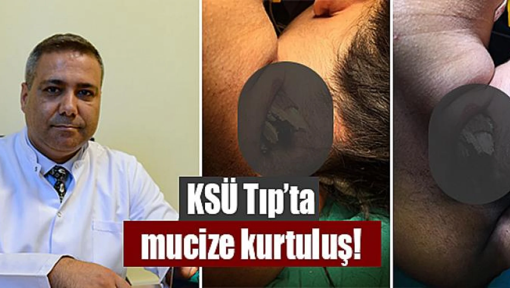 KSÜ Tıp'ta mucize kurtuluş!