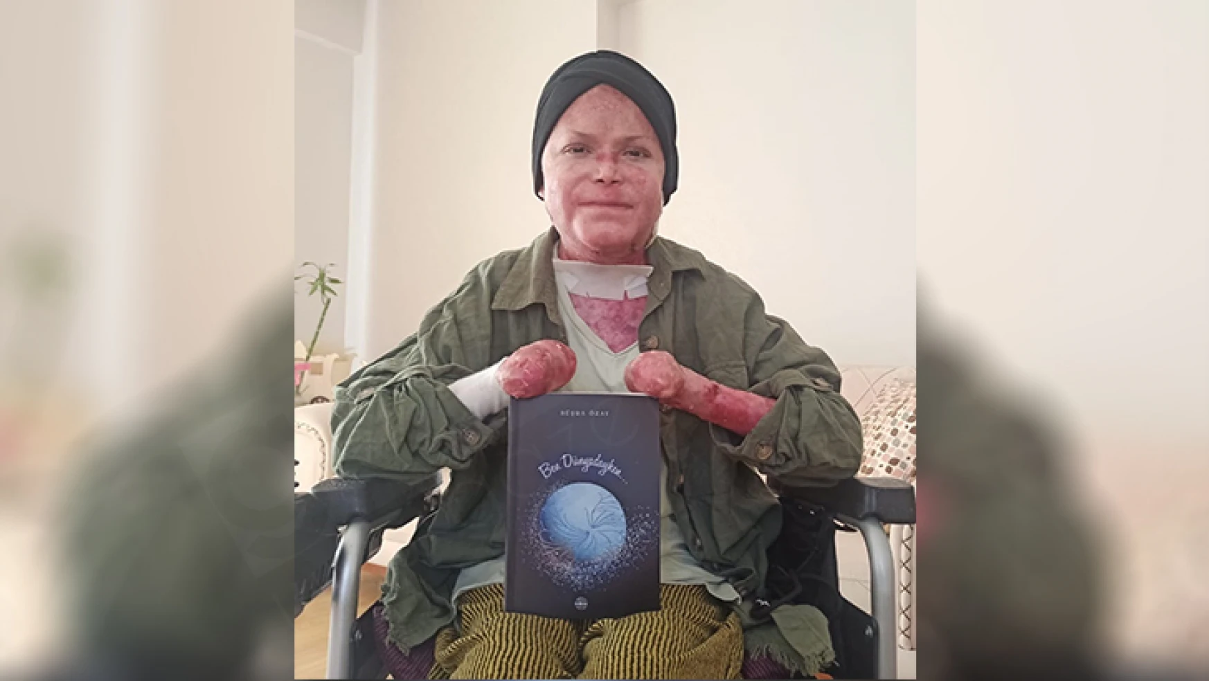Kelebek hastası Büşra, 'Ben Dünyadayken' adlı kitap yazdı