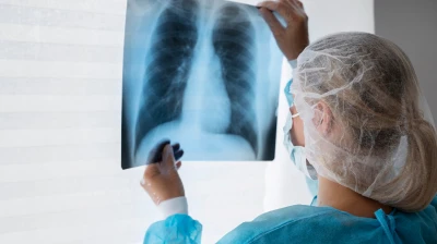 Akciğer kanserinde çevresel faktörlerin etkisi artıyor! Kahramanmaraş ilk sıralarda