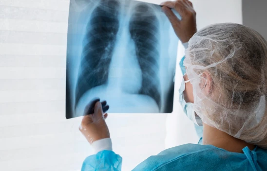 Akciğer kanserinde çevresel faktörlerin etkisi artıyor! Kahramanmaraş ilk sıralarda