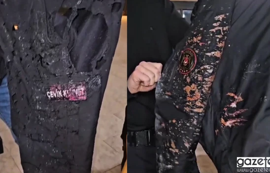 Saraçhane'de polis memuruna asitli saldırı