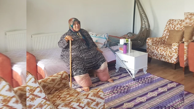 160 kilogram ağırlığındaki fil hastası 10 yıldır dışarıya çıkamıyor