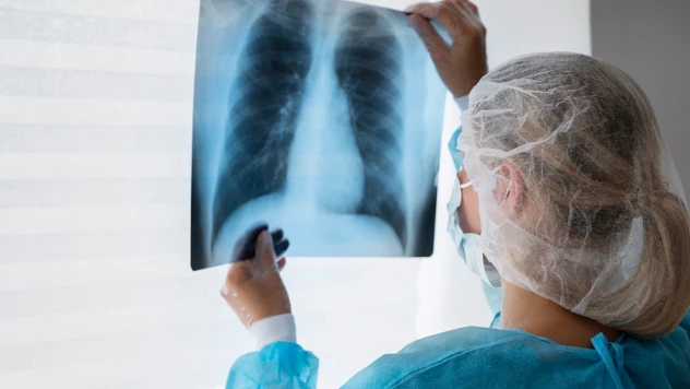 Akciğer kanserinde çevresel faktörlerin etkisi artıyor! Kahramanmaraş ilk sıralarda