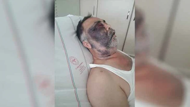 Baba ve oğlu tarafından darbedildiği öne sürülen engellinin tedavisi sürüyor