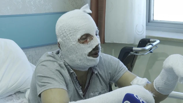 Gaz kaçağını fark edemeyen işitme engellinin vücudu yandı