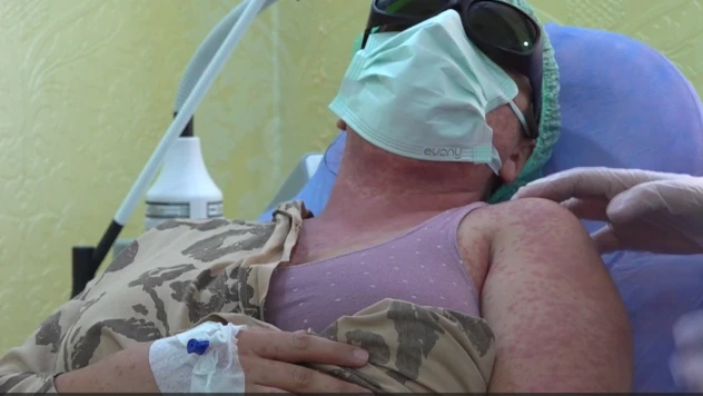 İnternetten ve aktardan aldıkları kremi kullanan 4 kişi hastanelik oldu