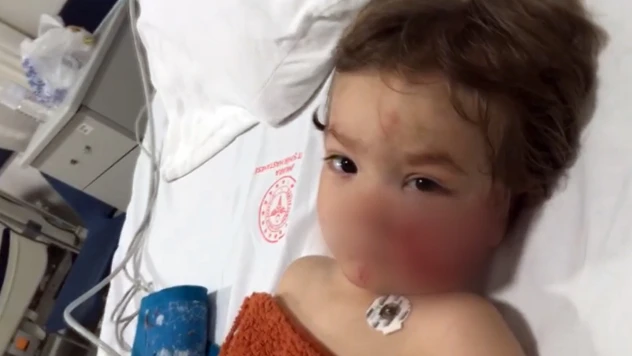 Pitbull cinsi köpeğin saldırısıyla 2 çocuk yaralandı