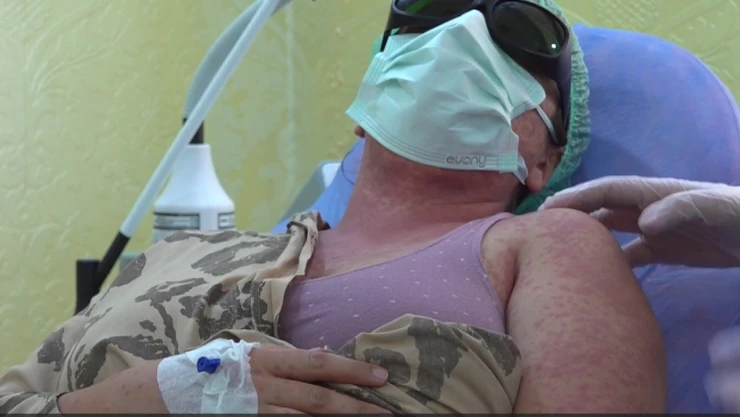 İnternetten ve aktardan aldıkları kremi kullanan 4 kişi hastanelik oldu