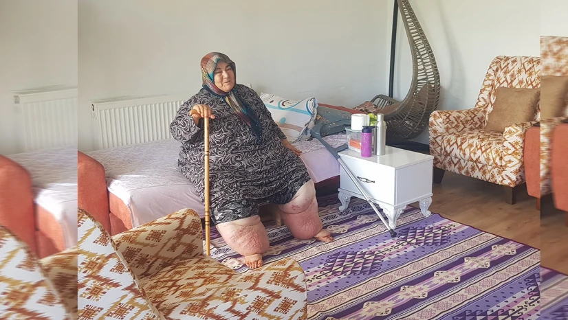 160 kilogram ağırlığındaki fil hastası 10 yıldır dışarıya çıkamıyor